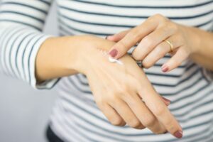 Woman applying cream to scar on her hand